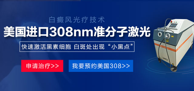 兰州中研白癜风医院